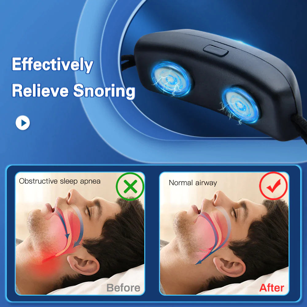 Smart anti Snoring Device EMS Pulse Stop Snore Portable Comfortable Sleep Well Stop Snore Health Care Sleep Apnea Aid USB